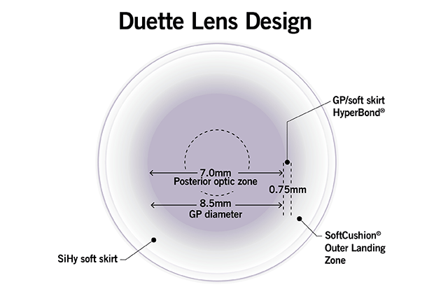 duette lens design